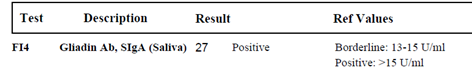 ASI Test results - 2