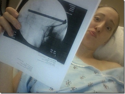 healthy ashley bike accident